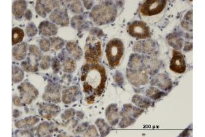 Immunoperoxidase of monoclonal antibody to MVK on formalin-fixed paraffin-embedded human salivary gland. (MVK Antikörper  (AA 297-396))