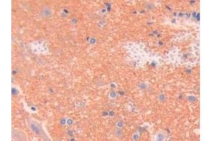 Detection of SPTAN1 in Rat Spinal cord Tissue using Polyclonal Antibody to Alpha-Fodrin (SPTAN1) (SPTAN1 Antikörper  (AA 2071-2269))