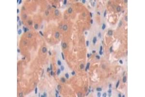 Used in DAB staining on fromalin fixed paraffin- embedded Kidney tissue (TNXB Antikörper  (AA 3824-4071))
