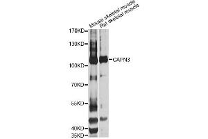Western blot analysis of extracts of various cell lines, using CAPN3 Antibody (ABIN1871434) at 1:1000 dilution. (Calpain 3 Antikörper)