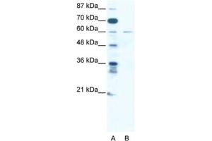 Western Blotting (WB) image for anti-Zinc Finger Protein 92 (ZNF92) antibody (ABIN2461312) (ZNF92 Antikörper)