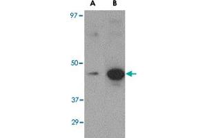 Western blot analysis of (A) 5 ng and (B) 25 ng of recombinant Hemagglutinin with Hemagglutinin monoclonal antibody, clone 1E6A7  at 1 ug/mL . (Hemagglutinin Antikörper  (Internal Region))