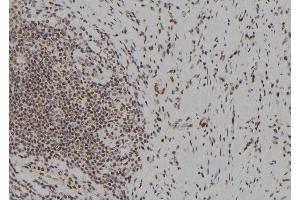 ABIN6279633 at 1/100 staining Human gastric tissue by IHC-P. (NOL9 Antikörper  (Internal Region))
