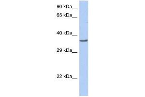 WB Suggested Anti-TFDP1 Antibody Titration:  0. (DP1 Antikörper  (Middle Region))