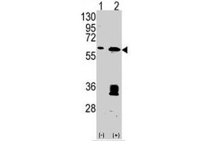 Western blot analysis of MDM2 (arrow) using MDM2 polyclonal antibody . (MDM2 Antikörper  (C-Term))