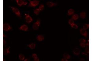 ABIN6276942 staining HeLa by IF/ICC. (CADM1 Antikörper  (Internal Region))