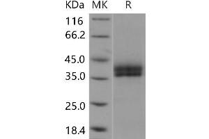Western Blotting (WB) image for Kallikrein 11 (KLK11) protein (His tag) (ABIN7196663) (Kallikrein 11 Protein (KLK11) (His tag))