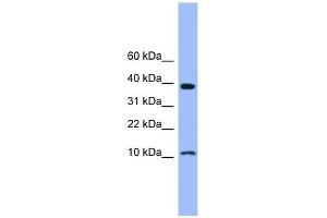 WB Suggested Anti-CSTB Antibody Titration: 0. (CSTB Antikörper  (N-Term))