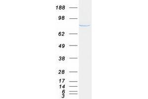 Western Blotting (WB) image for phosphofructokinase, Muscle (PFKM) protein (Myc-DYKDDDDK Tag) (ABIN2728752)