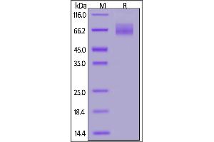 SDS-PAGE (SDS) image for Guanylate Cyclase 2C (Heat Stable Enterotoxin Receptor) (GUCY2C) (AA 24-430) (Active) protein (His tag,FITC) (ABIN6973085)