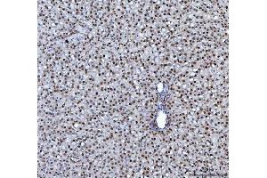 IHC analysis of hnRNP L/HNRNPL using anti-hnRNP L/HNRNPL antibody (ABIN7600130). (HNRNPL Antikörper  (AA 152-569))