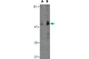 Western blot analysis of TBC1D10C in human spleen tissue lysate with TBC1D10C polyclonal antibody  at (A) 1 and (B) 2 ug/mL . (Carabin Antikörper  (N-Term))