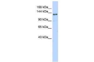 EIF4G2 antibody used at 1 ug/ml to detect target protein. (EIF4G2 Antikörper  (N-Term))
