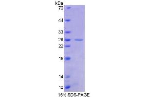 SDS-PAGE analysis of Human FLI1 Protein. (FLI1 Protein)