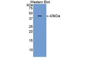 Western blot analysis of the recombinant protein. (C8B Antikörper  (AA 161-503))