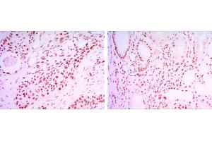 Immunohistochemistry (IHC) image for anti-Sirtuin 1 (SIRT1) antibody (ABIN969396)