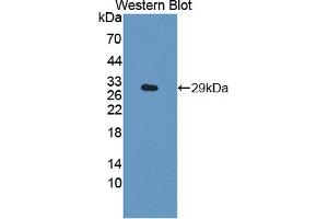 Figure. (DIXDC1 Antikörper  (AA 485-683))
