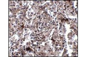 Immunohistochemistry of KCTD15 in human spleen tissue with this product at 2. (KCTD15 Antikörper  (C-Term))