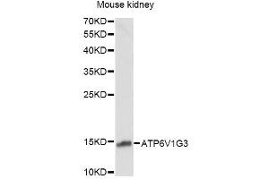 Western blot analysis of extracts of mouse kidney, using ATP6V1G3 antibody. (ATP6V1G3i Antikörper)