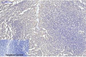 Immunohistochemical analysis of paraffin-embedded human tonsil tissue. (Cytochrome C Antikörper)