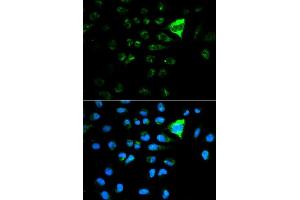 Immunofluorescence analysis of MCF7 cell using CDKN1A antibody. (p21 Antikörper  (AA 43-142))