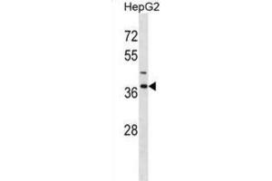 Western Blotting (WB) image for anti-Immunoglobulin (CD79A) Binding Protein 1 (IGBP1) antibody (ABIN2998604) (IGBP1 Antikörper)