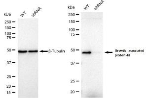 Western blotting analysis using Growth associated protein 43 antibody (ABIN7798804). (Rekombinanter GAP43 Antikörper)