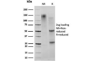 SDS-PAGE Analysis Purified CD27 Mouse Monoclonal Antibody (203. (CD27 Antikörper)
