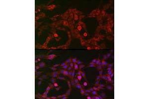 Immunofluorescence (IF) image for anti-Low Density Lipoprotein Receptor-Related Protein 5 (LRP5) (AA 1000-1250) antibody (ABIN1513164)