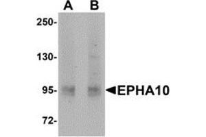 Western Blotting (WB) image for anti-EPH Receptor A10 (EPHA10) (N-Term) antibody (ABIN1031373)