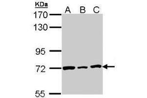 Western Blot: Lamin B2 antibody staining of H1299 (A), Hela (B), HepG2 (C) whole cell lysates (30 µg) at 1/3000 dilution, 7. (Lamin B2 Antikörper  (AA 221-460))