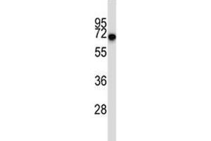 Western Blotting (WB) image for anti-CD5 (CD5) (AA 203-232) antibody (ABIN3028552)