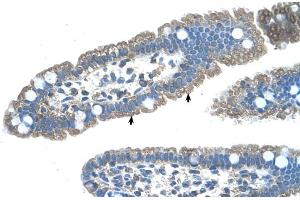 Human Intestine (S1PR5 Antikörper  (N-Term))