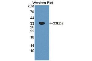 Detection of Recombinant PLCb2, Mouse using Polyclonal Antibody to Phospholipase C Beta 2 (PLCb2) (Phospholipase C beta 2 Antikörper  (AA 1-250))