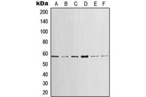 Western blot analysis of LCK expression in HeLa (A), MCF7 (B), mouse brain (C), mouse heart (D), rat brain (E), rat heart (F) whole cell lysates. (LCK Antikörper  (Center))