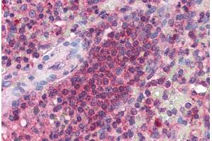 Human Spleen (formalin-fixed, paraffin-embedded) stained with ARMETL1 antibody ABIN351454 at 5 ug/ml followed by biotinylated goat anti-rabbit IgG secondary antibody ABIN481713, alkaline phosphatase-streptavidin and chromogen. (CDNF Antikörper  (C-Term))