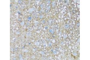 Immunohistochemistry of paraffin-embedded Rat brain using ATP1B2 Polyclonal Antibody at dilution of 1:100 (40x lens). (ATP1B2 Antikörper)