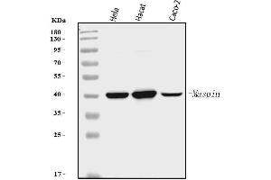 Western blot analysis of MASPIN using anti-MASPIN antibody (ABIN7599298).