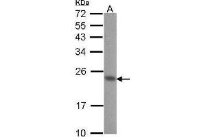 WB Image Sample (30 ug of whole cell lysate) A: A431 , 12% SDS PAGE CIB1 antibody antibody diluted at 1:1000 (CIB1 Antikörper)
