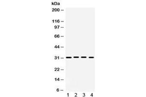 Western blot testing of 1) rat brain, 2) rat heart, 3) mouse heart and 4) human 22RV1 lysate with KChIP2 antibody. (KCNIP2 Antikörper)