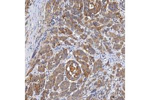 IHC analysis of OAT3/SLC22A8 using anti-OAT3/SLC22A8 antibody (ABIN7599422).