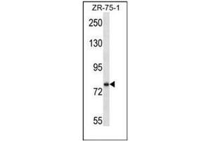 Western blot analysis of SIM1 Antibody (N-term) in ZR-75-1 cell line lysates (35ug/lane). (SIM1 Antikörper  (N-Term))