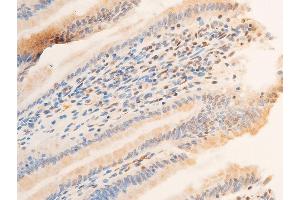 ABIN6256329 and ABIN6267218 at 1/100 staining rat intestinal tissue sections by IHC-P.
