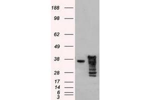 Image no. 1 for anti-DNA Fragmentation Factor, 45kDa, alpha Polypeptide (DFFA) antibody (ABIN1498773) (DFFA Antikörper)