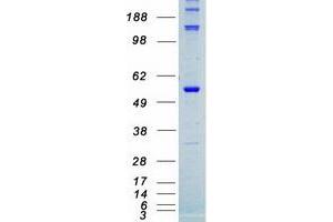 Validation with Western Blot