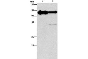 Western Blot analysis of Mouse brain and Human brain malignant glioma tissue using KIF3A Polyclonal Antibody at dilution of 1:750 (KIF3A Antikörper)