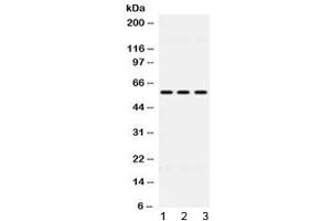 Western blot testing of 1) rat liver, 2) mouse HEPA and 3) human HeLa lysate with ALDH7A1 antibody at 0. (ALDH7A1 Antikörper  (AA 333-369))