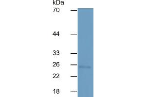 Western Blotting (WB) image for Interleukin 6 (IL6) ELISA Kit (ABIN6730858)