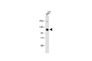 Anti-DDR1 Antibody (Center) at 1:500 dilution + A431 whole cell lysate Lysates/proteins at 20 μg per lane. (DDR1 Antikörper  (AA 299-330))