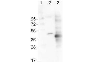 Western Blot using  Immunochemical's Mouse Anti-6x-His Epitope Tag Monoclonal Antibody showing detection of the 6xHis sequence on N-terminally-tagged (lane 2) and C-terminally-tagged recombinant proteins (lane 3).